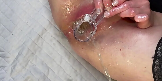 he pee into my pussy by speculum and i squirt too